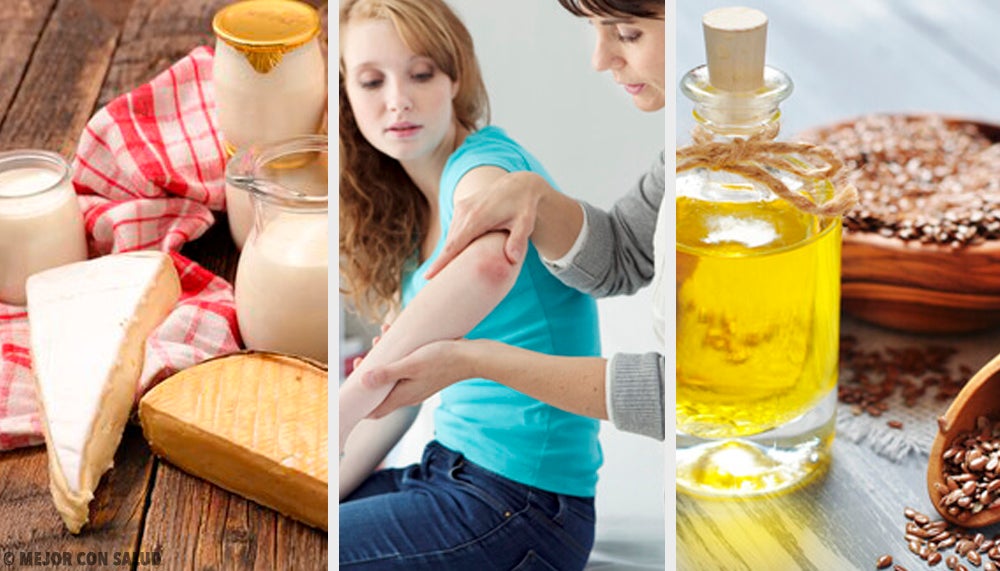 Putem vindeca psoriazisul cu remedii naturiste?